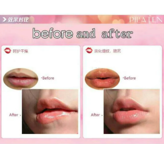 Pilaten-Lips-Mask-Hot-Summer-Girl